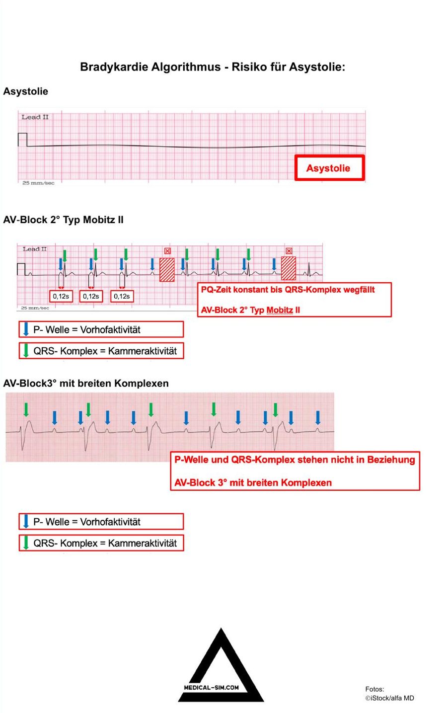 Visualisierungshilfe zum Audioprogramm Bradykarde Peri-Arrest-Rhythmen