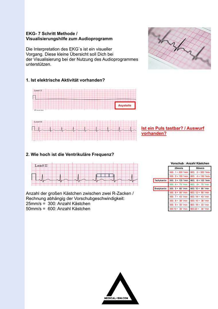 Vorschau der EKG-Visualisierungshilfe als PDF