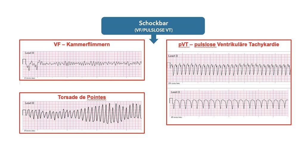 Visualisierungshilfe zum Audioprogramm Reanimation